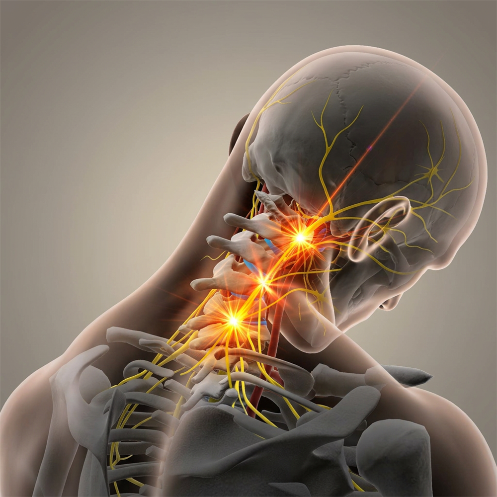 sympathetic nerve irritation because of poor posture